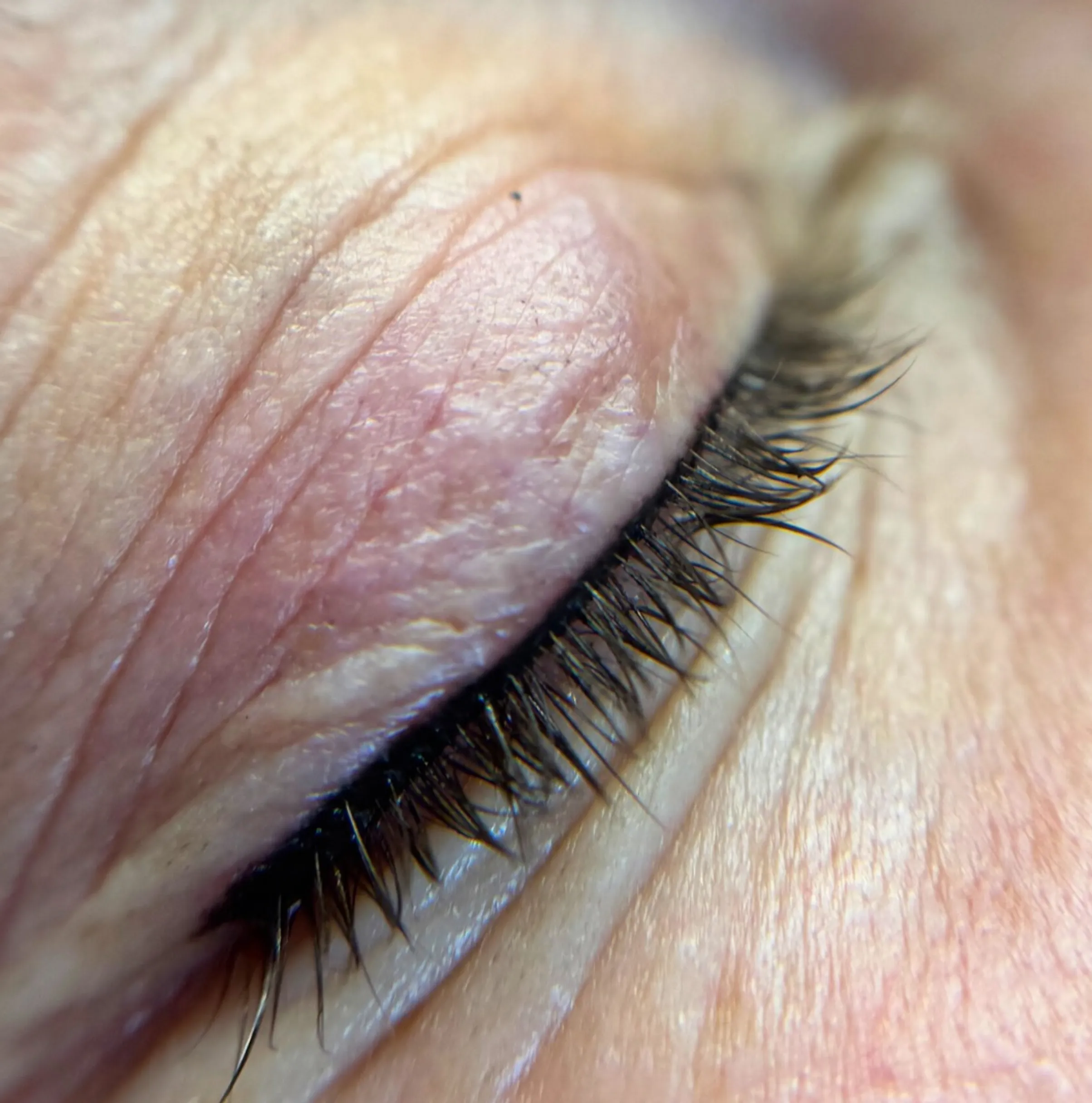 lash line tattoo swelling and flaking