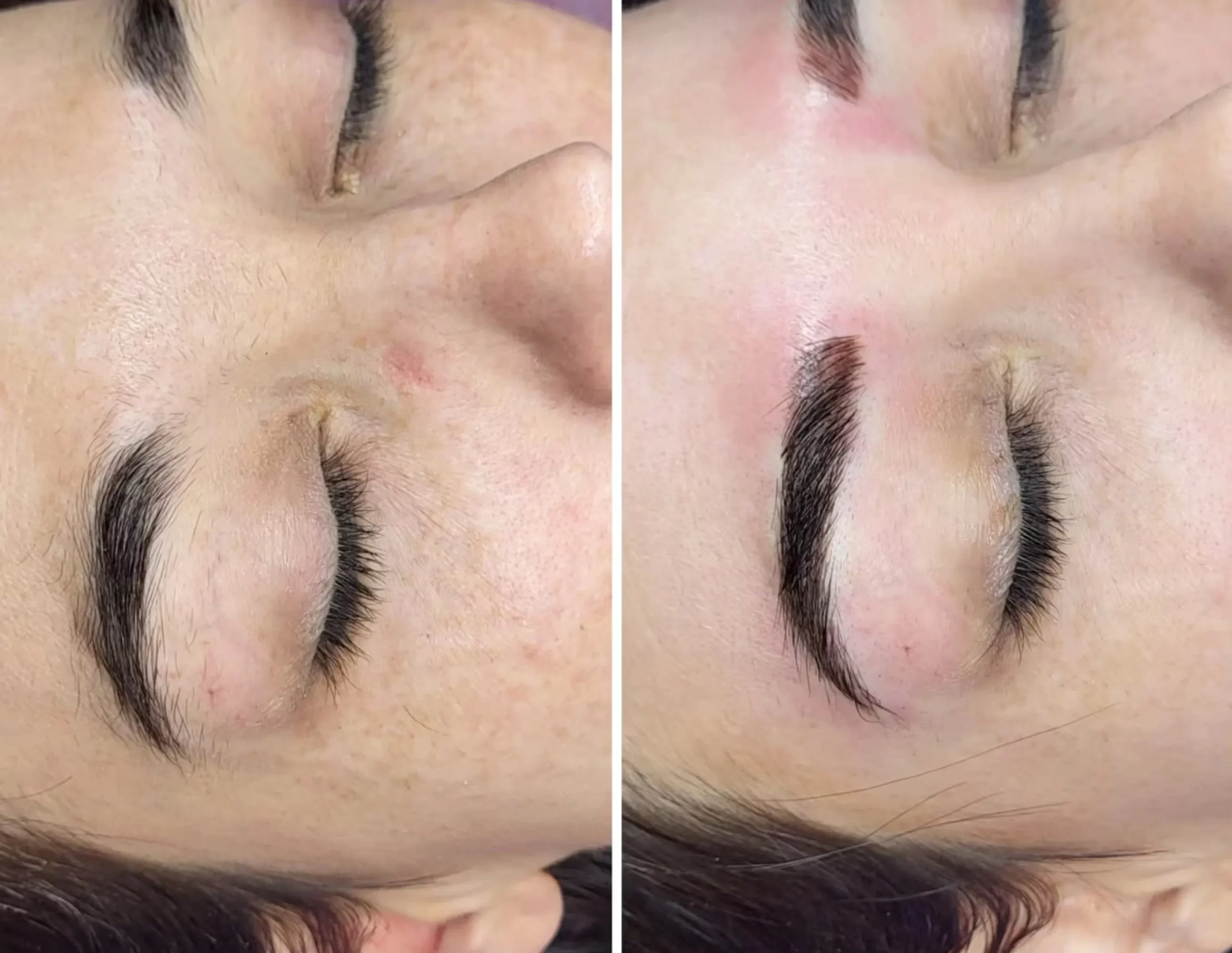 Brow mapping transfer skills