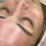 skin barrier nutrition